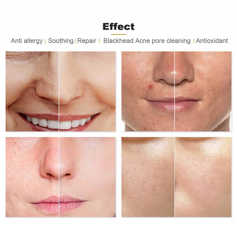 Shape Tactics Hydroge Pro Oxygen Skin Rejuvenation System