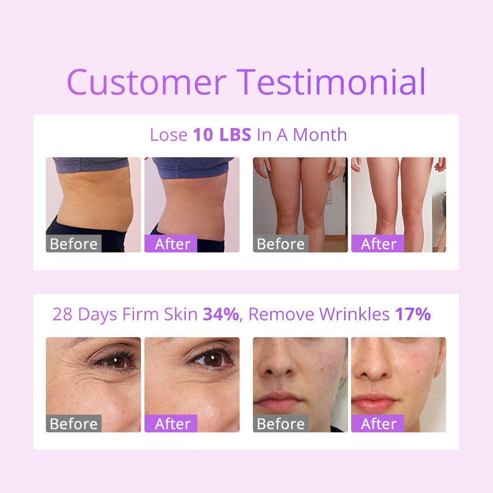 Shape Tactics S-Shape 30K Cavitation LED Laser System
