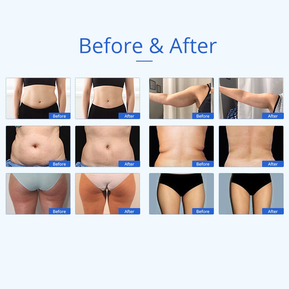Shape Tactics 6-in-1 Unoisetion Cavitation RF 160mW System