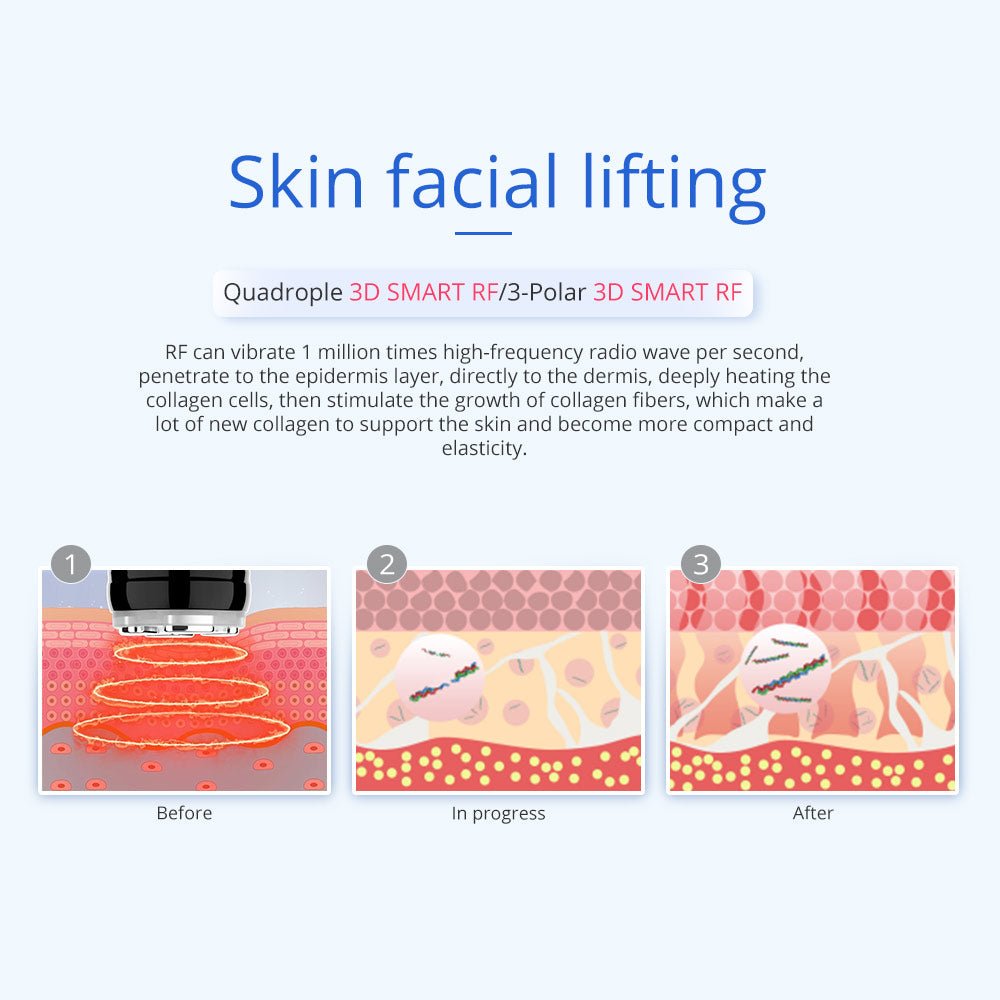 Shape Tactics 6-in-1 Unoisetion Cavitation RF 160mW System