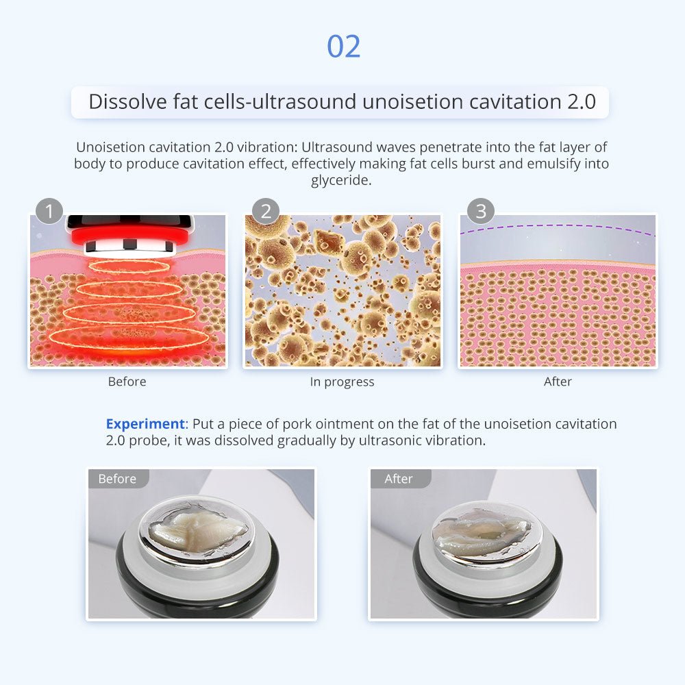 Shape Tactics 6-in-1 Unoisetion Cavitation RF 160mW System
