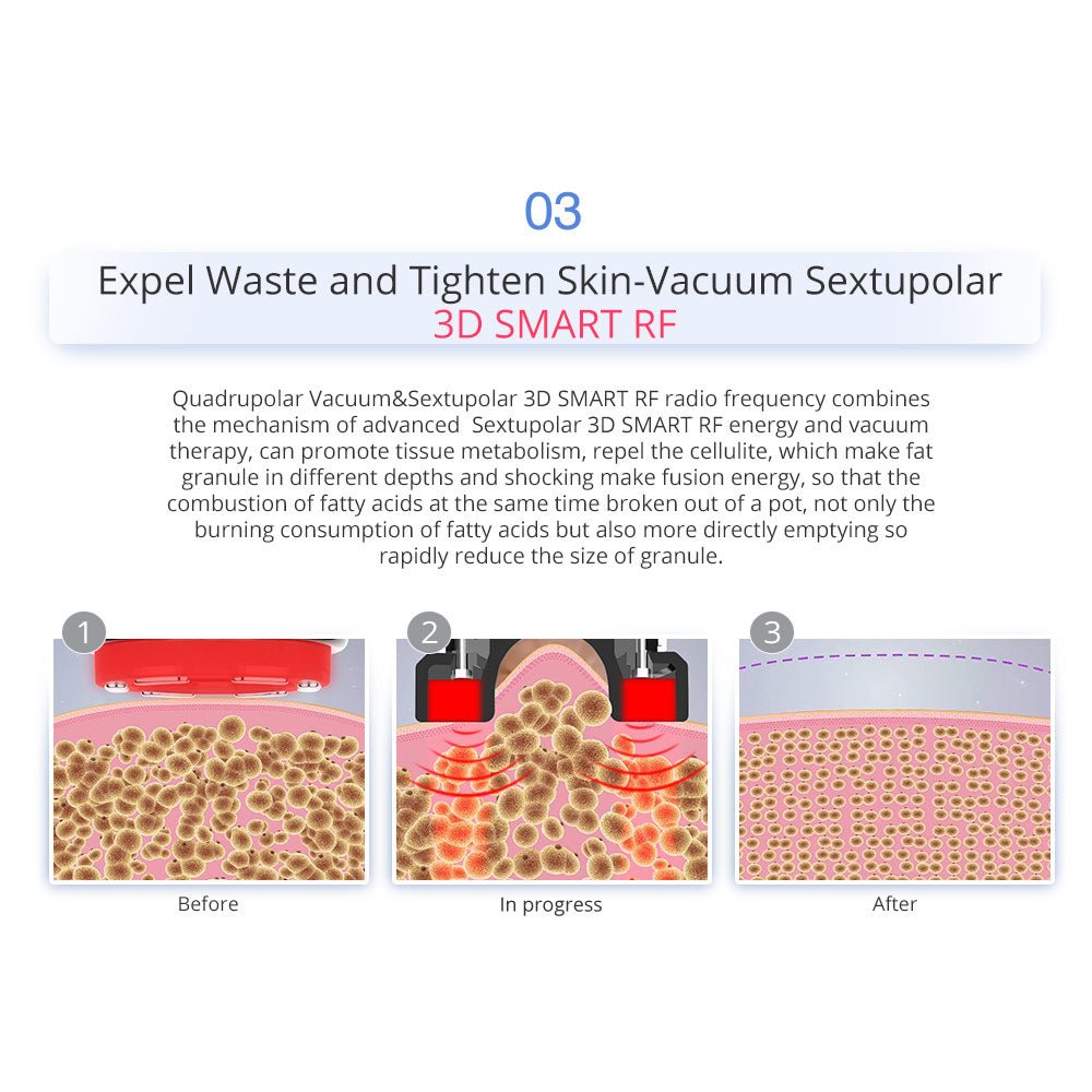 Shape Tactics 7-in-1 40K Ultrasonic Cavitation & RF Hot-Cold Therapy System