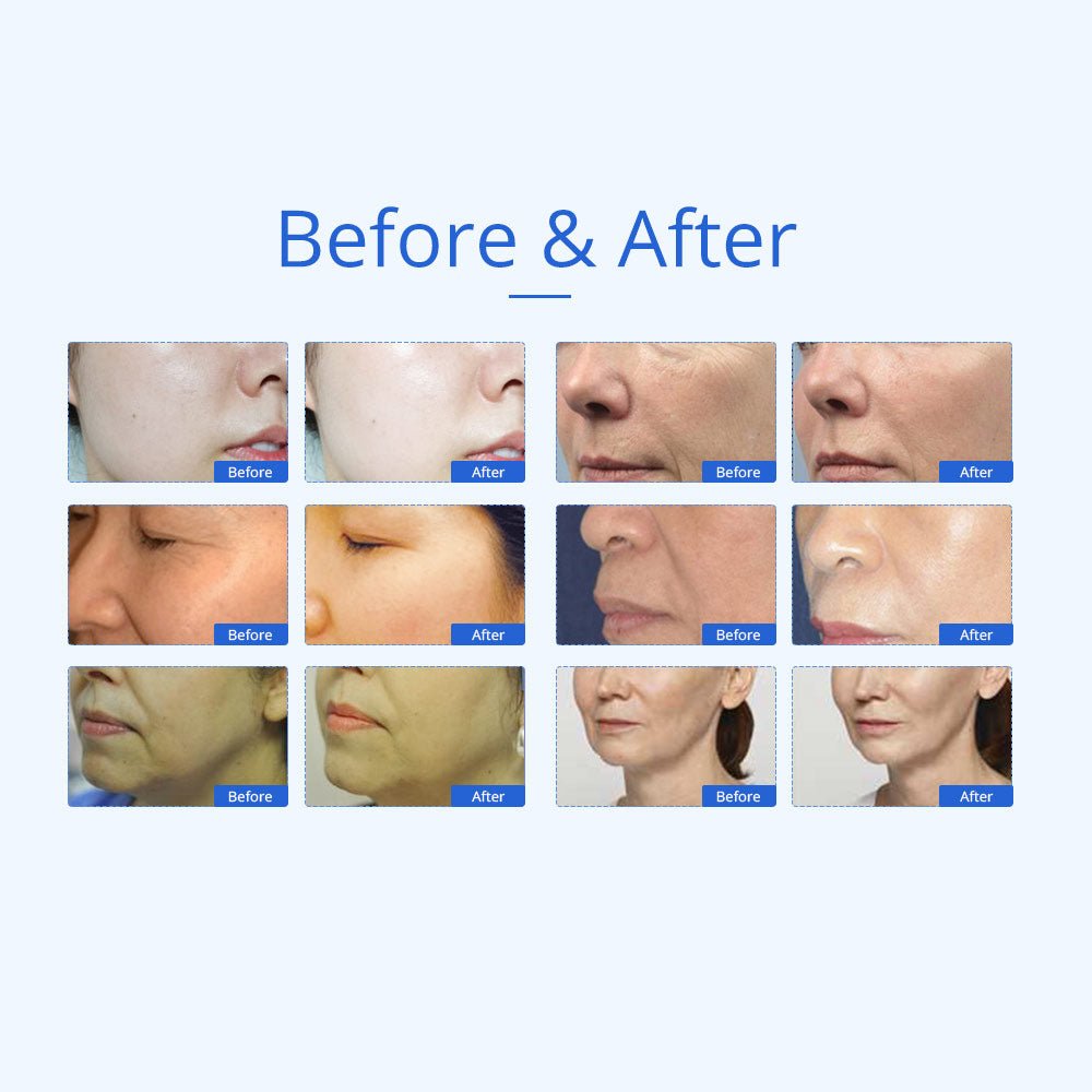 Shape Tactics 7-in-1 40K Ultrasonic Cavitation & RF Hot-Cold Therapy System