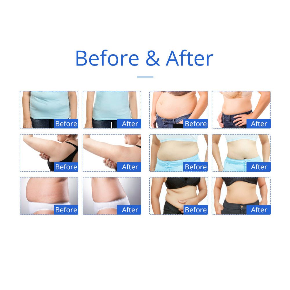 Shape Tactics 8-in-1 Microcurrent RF Cavitation & Laser Contouring System