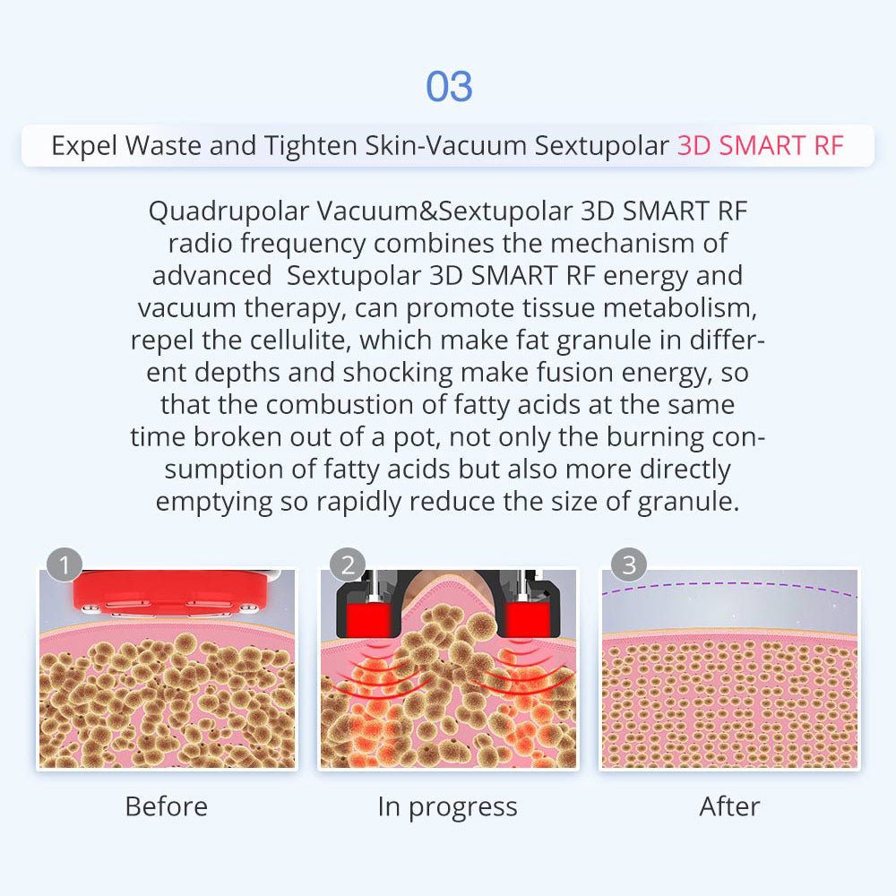 Shape Tactics 8-in-1 Microcurrent RF Cavitation & Laser Contouring System