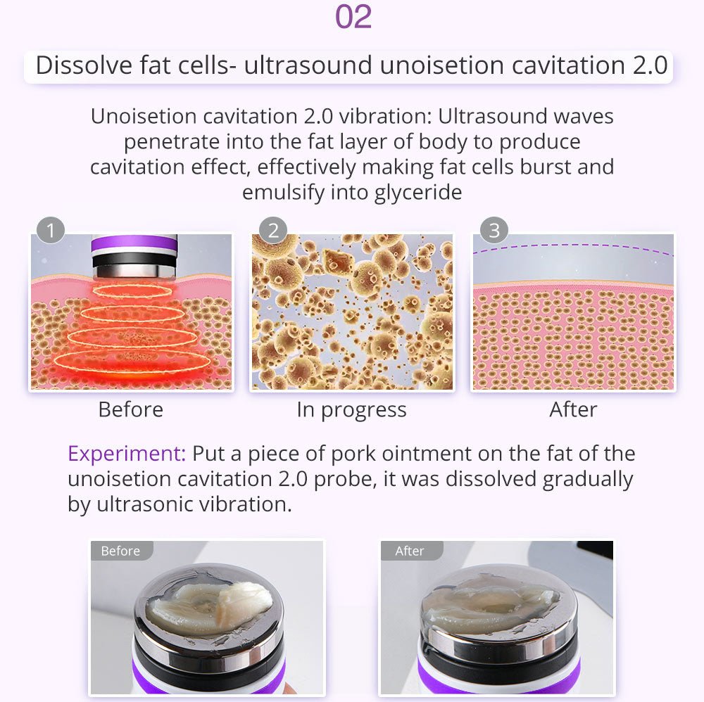Shape Tactics 9-in-1 Lipo Microcurrent Photon Ultrasonic Cavitation System
