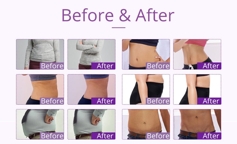 Shape Tactics 9-in-1 Lipo Microcurrent Photon Ultrasonic Cavitation System