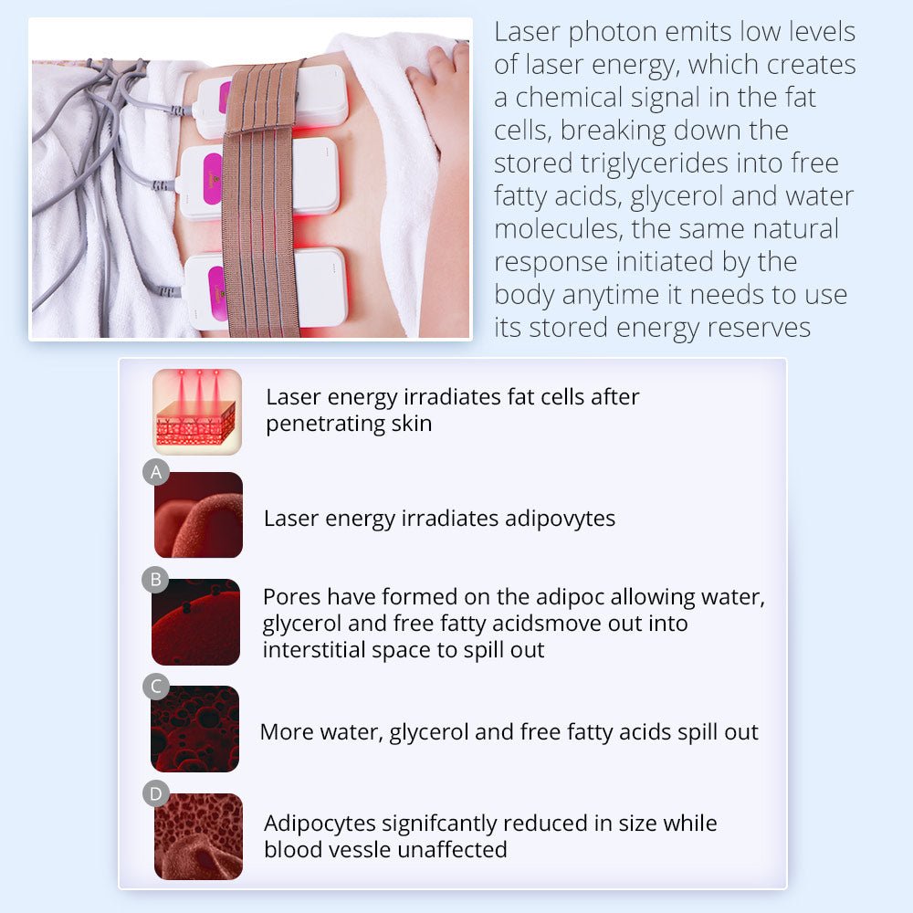 Shape Tactics Advanced 5-in-1 Cryolipolysis 40K Cavitation RF Lipo Laser System