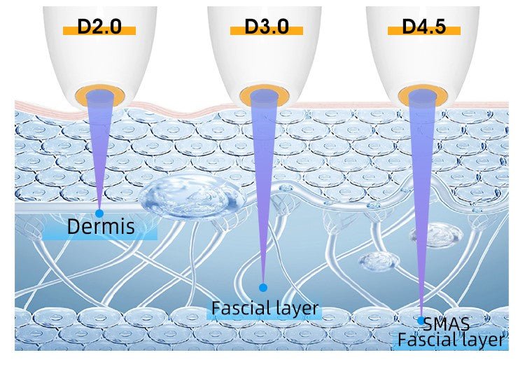 Shape Tactics Advanced 7D HIFU Skin Care System