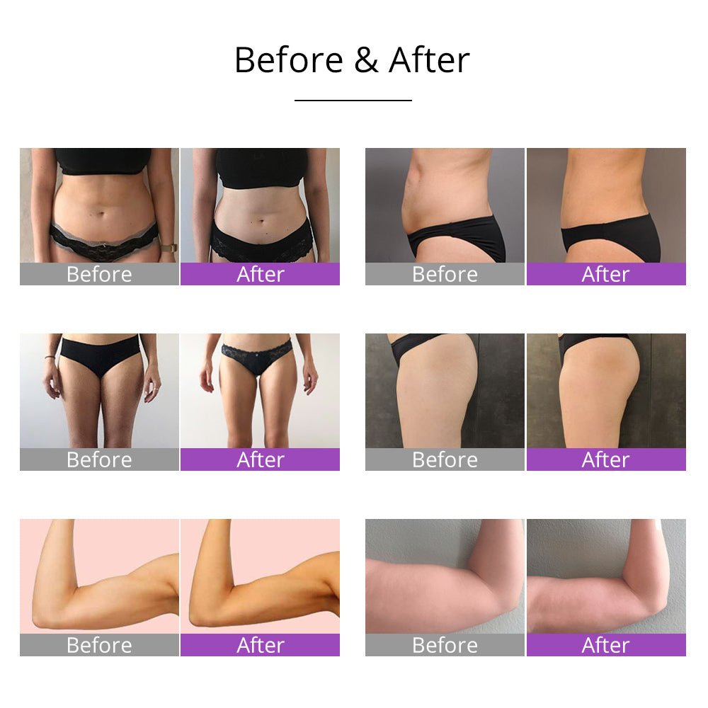 Shape Tactics 6-in-1 Cavitation RF Vacuum Lipo Laser Contouring System