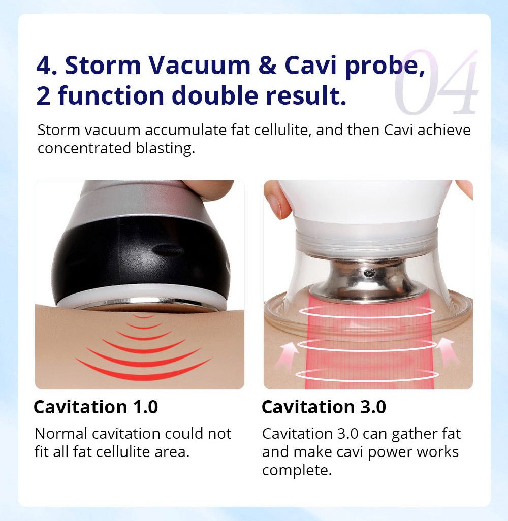 Shape Tactics CaVstorm Cavitation RF System