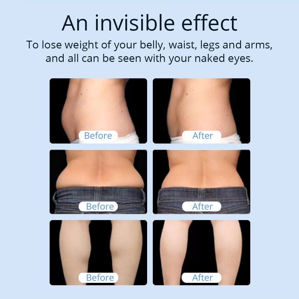 Shape Tactics CaVstorm Cavitation RF System