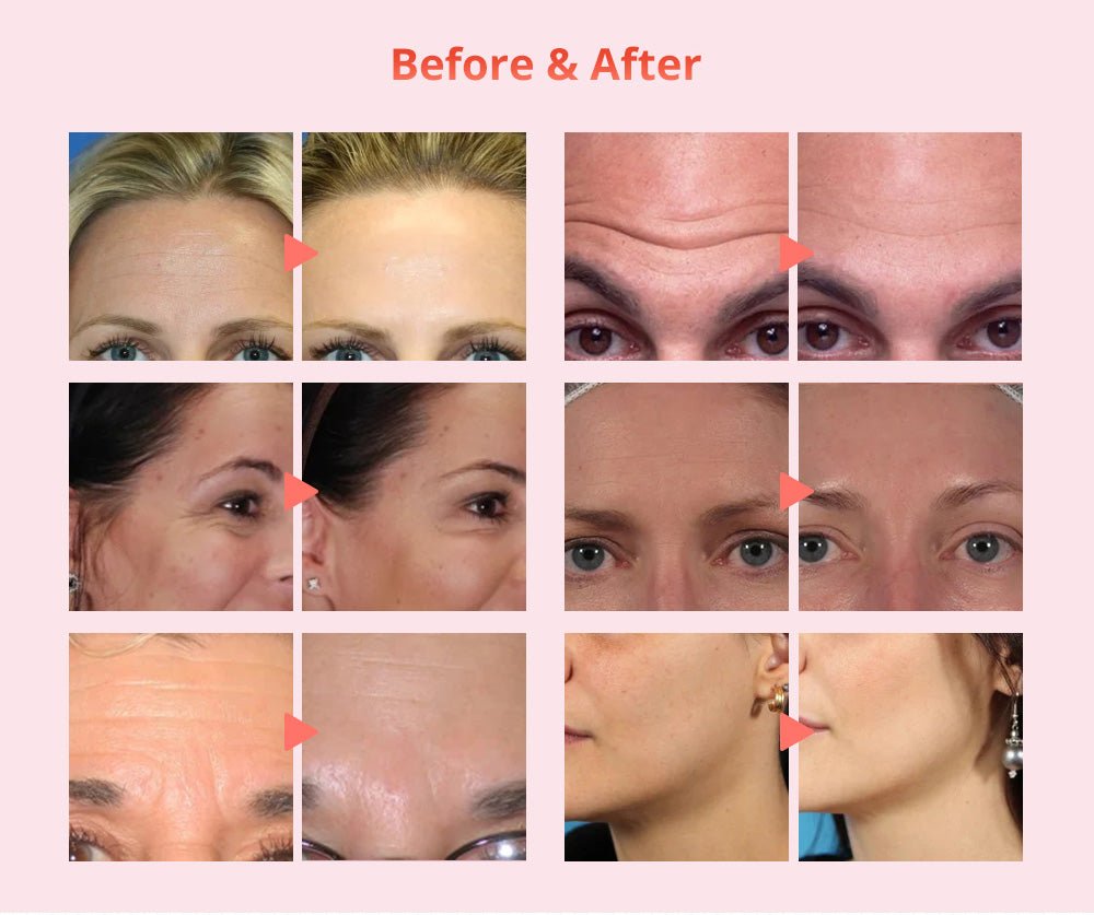Shape Tactics Diamond Dermabrasion & Ultrasonic Skin Care System