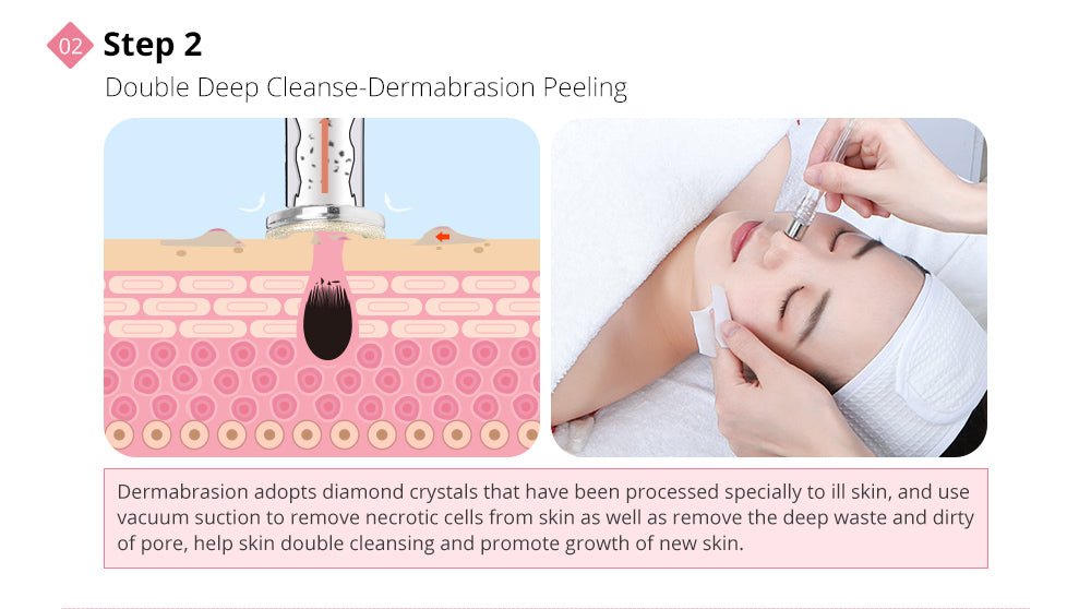 Shape Tactics Diamond Dermabrasion & Ultrasonic Skin Care System