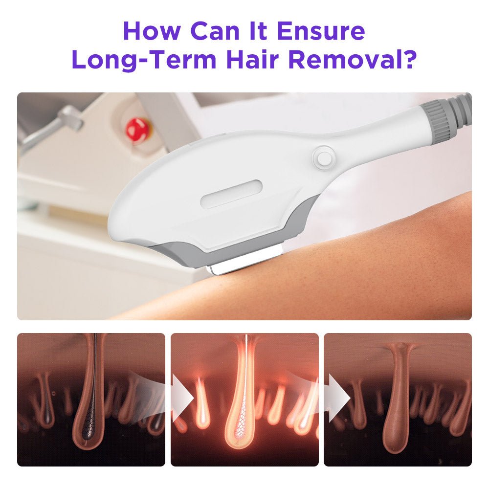 Shape Tactics IPL Hair Removal and Skin Rejuvenation System