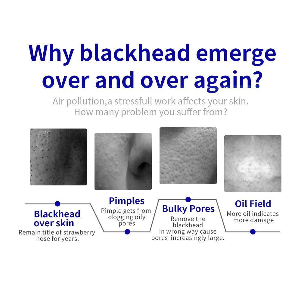 Shape Tactics Microdermabrasion Vacuum Spray for Deep Facial Exfoliation