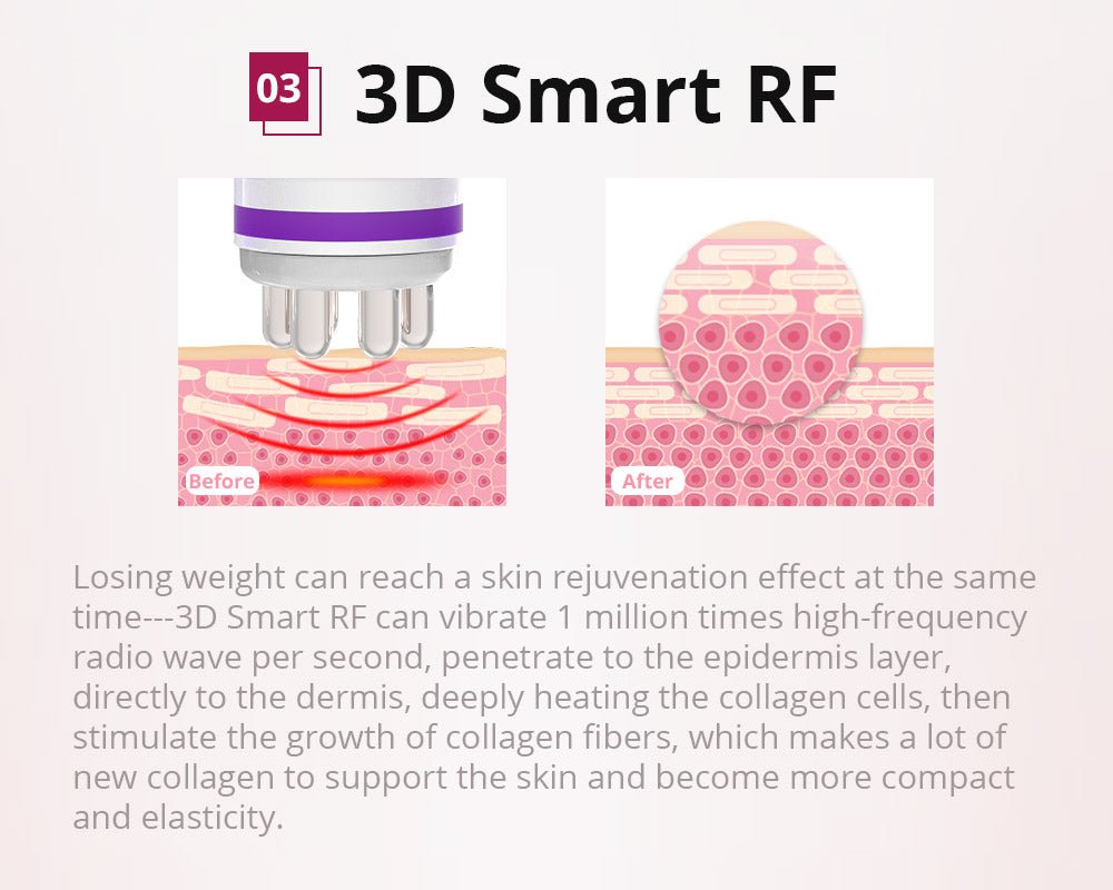 Shape Tactics 6-in-1 Cavitation Lipo Laser Photon RF System