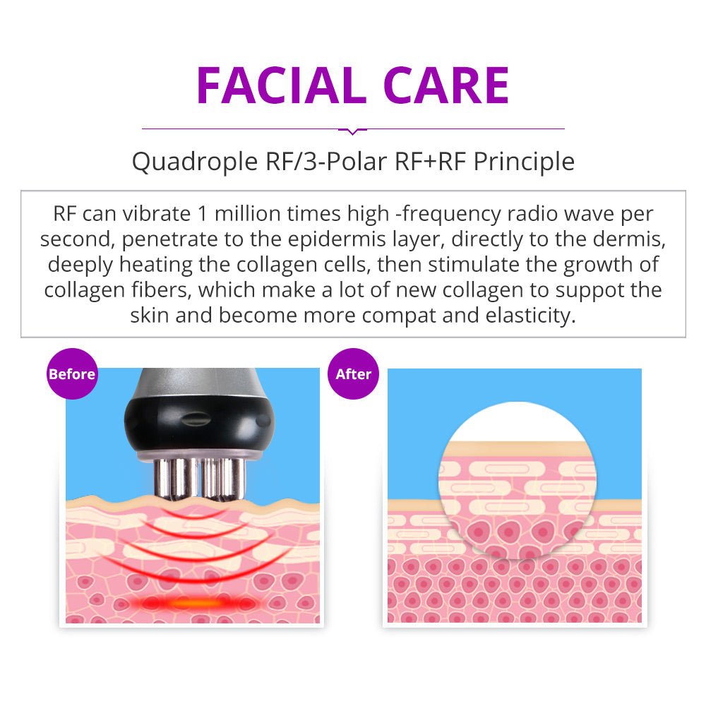 Shape Tactics Portable 5-in-1 Cavitation RF Vacuum Contouring System