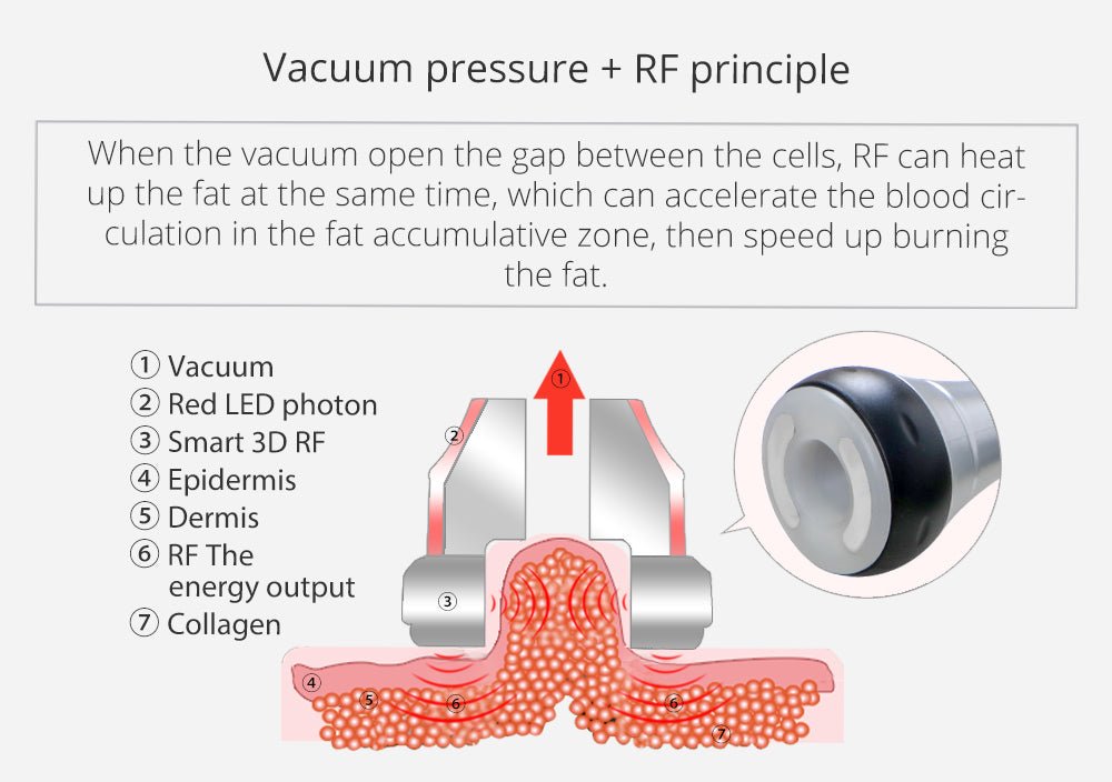 Shape Tactics Portable 6-in-1 Cavitation RF Vacuum Lipo Laser System