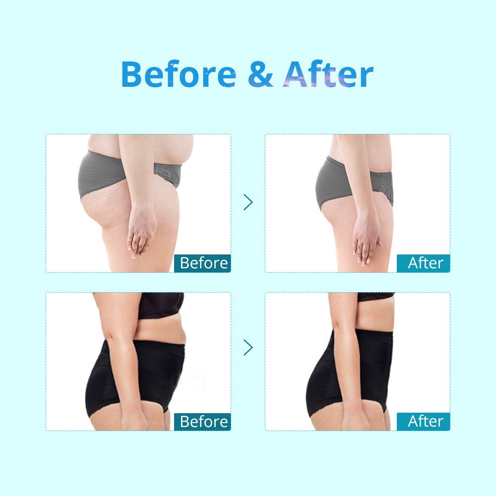 Shape Tactics Portable Double-Handle Cryolipolysis Contouring System
