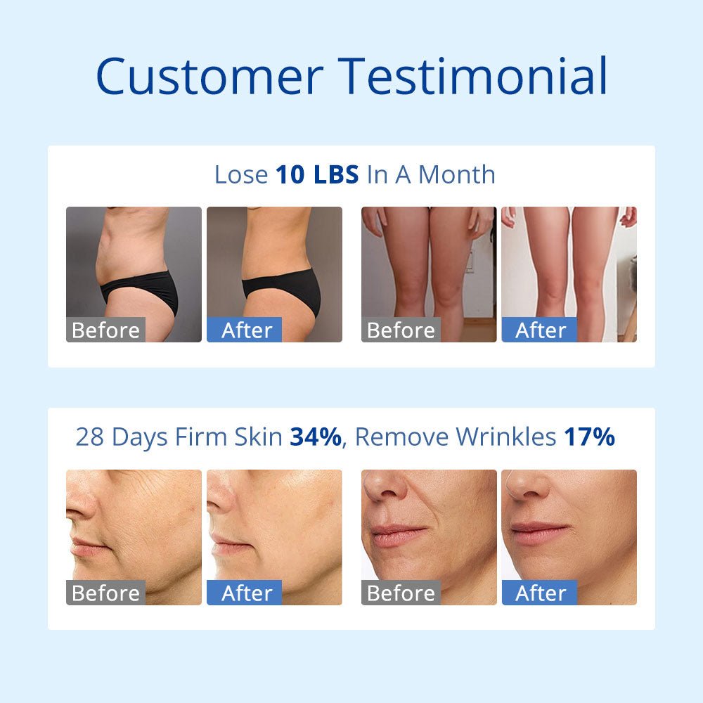 Shape Tactics S-Shape 30K Cavitation RF & 160mW Lipo Laser System