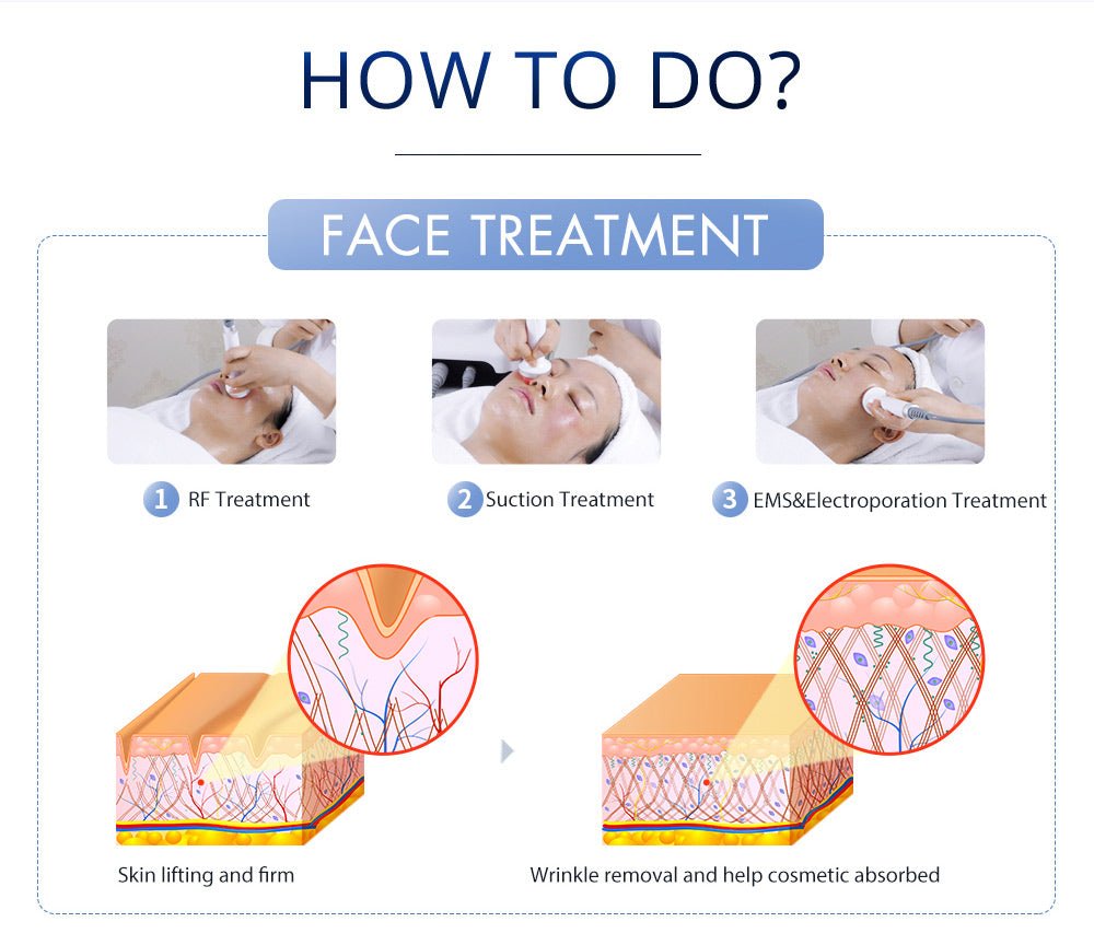 Shape Tactics S-Shape Pro 30K Cavitation RF Contouring System