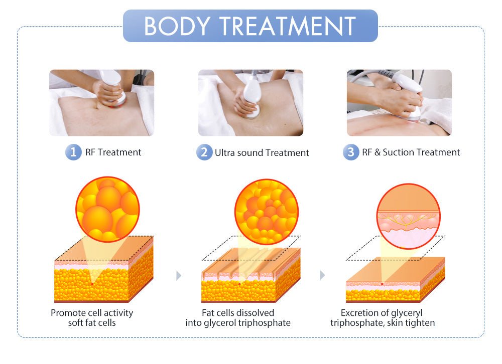 Shape Tactics S-Shape Pro 30K Cavitation RF Contouring System