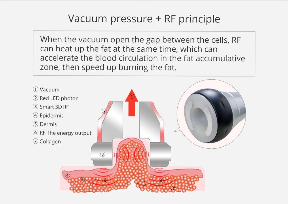 Shape Tactics Unoisetion 40K Cavitation Ultrasound RF Vacuum Photon System