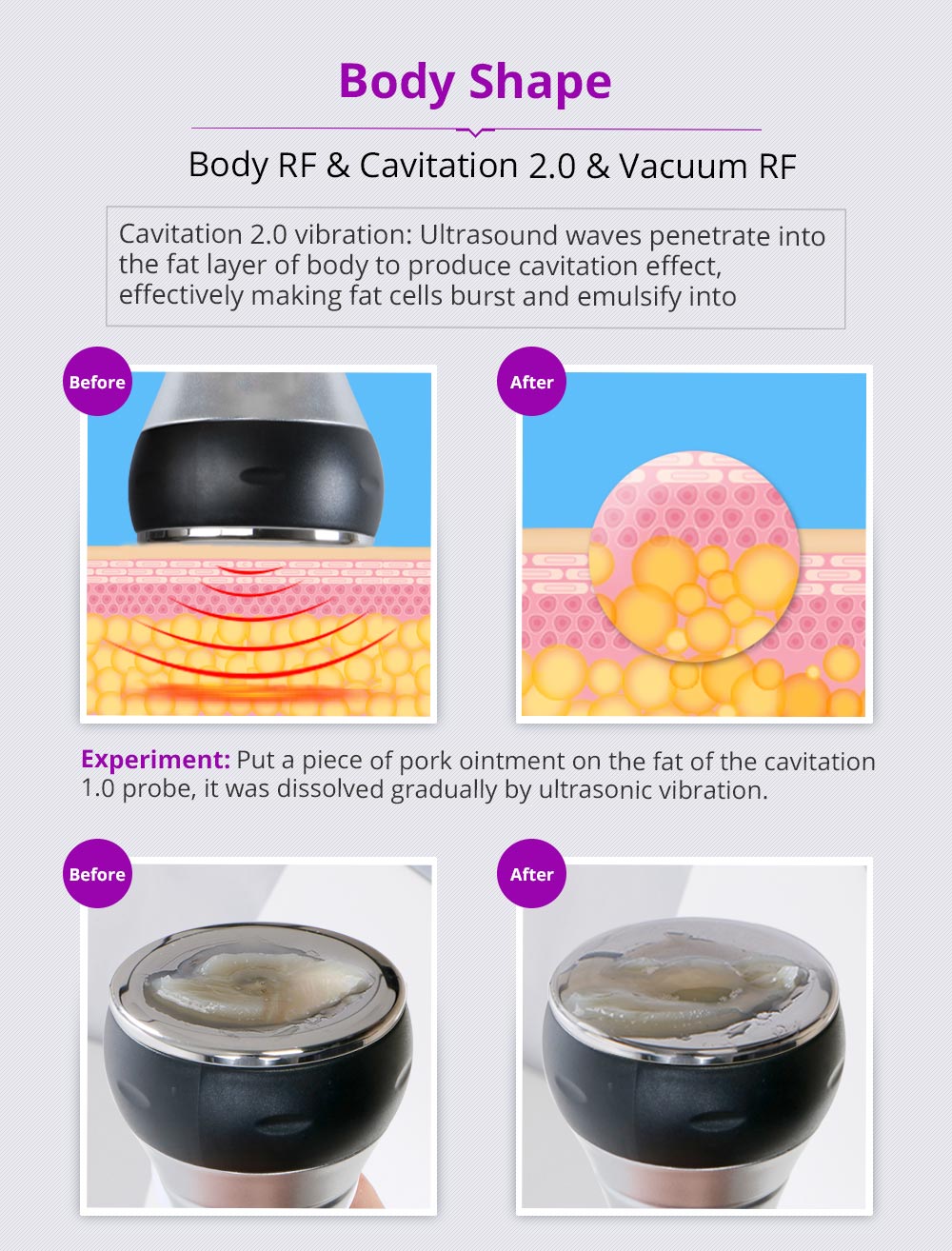 Shape Tactics Unoisetion 40K Cavitation Ultrasound RF Vacuum Photon System