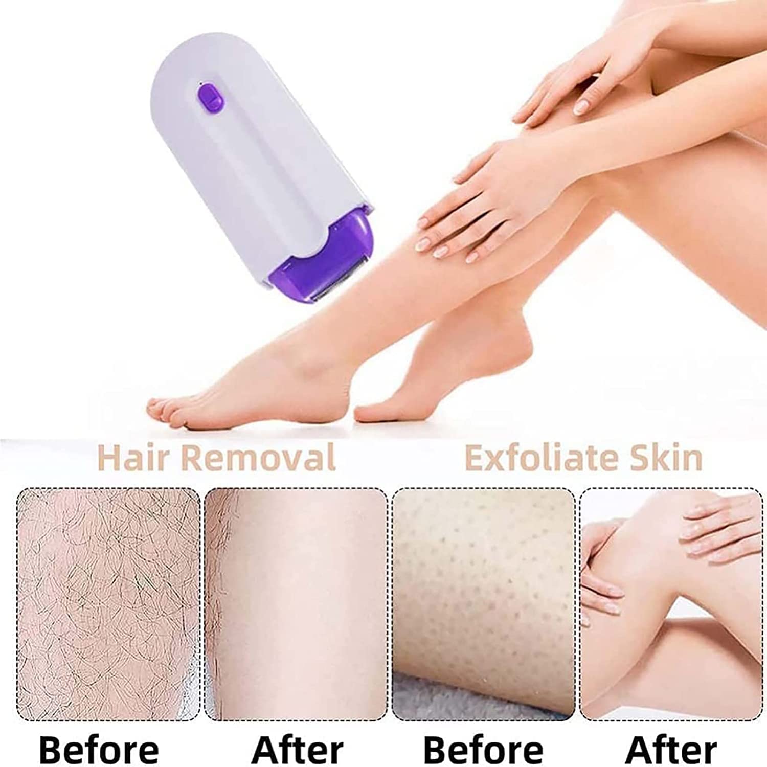 Smartshavy-Smartshavy Hair Eraser,Smart Shavey,Sillky Smoth Hair Eraser for Women,Smart Shavey Laser Hair Removal,Smart Shavy Unisex Hair Eraser,Hair Remover,Lumishave Hair Remover (1SET)