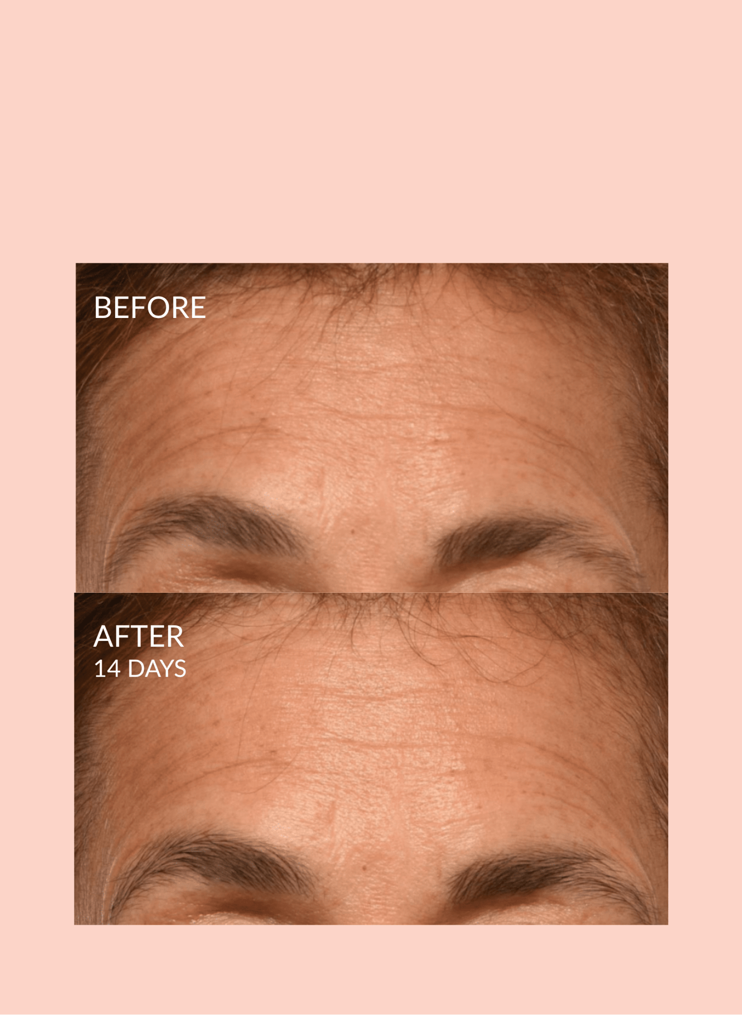 Triple Lift Molecule Mask