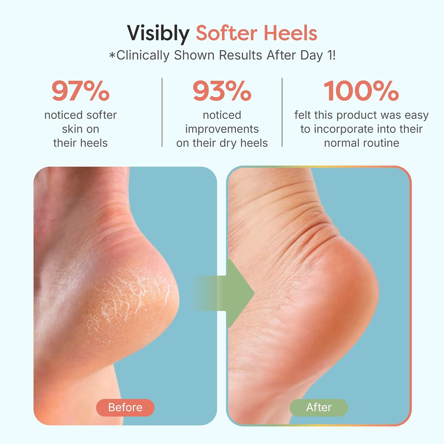 ZenToes Moisturizing Socks for Cracked Heel Treatment - Vitamin E, Olive Oil and Jojoba Oil Infused Heel Socks to Soften and Hydrate (Fuzzy Blue, Regular)