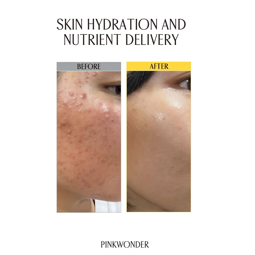 PINKWONDER USDA Organic Jojoba Oil | 100% Pure, Cold-Pressed & Vitamin E-Rich Oil for Skin | Non-Greasy, Fast-Absorbing for Face, 1.69oz (50ml)