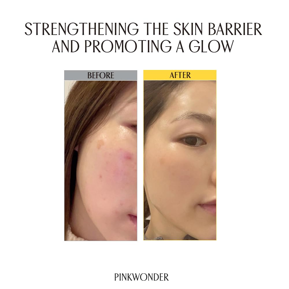 PINKWONDER Jojoba Vita Cream 3.38oz (100ml), Jojoba Oil and vitamin B12 Face Cream, Soothing for Sensitive Skin, Hypoallergenic, Korean Skincare