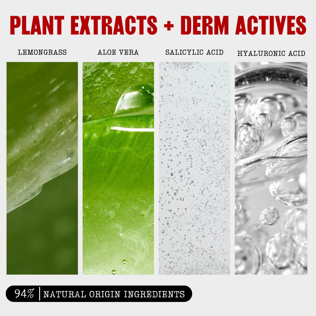 Thayers Blemish Clearing Salicylic Acid Toner, Acne Treatment Face Toner with 2% Salicylic Acid, Soothing and Non-Stripping Skin Care, 12 Fl Oz