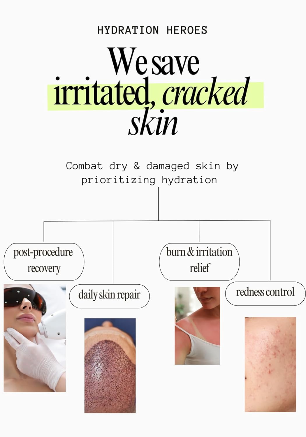 9% Panthenol Intensive Cream – Soothing Redness, Acne, Sunburn & Skin Recovery with Aloe Vera & Hyaluronic Acid – Post-Laser, Facelift, Tattoo, Burn & Hair Transplant Care, 3.4 oz