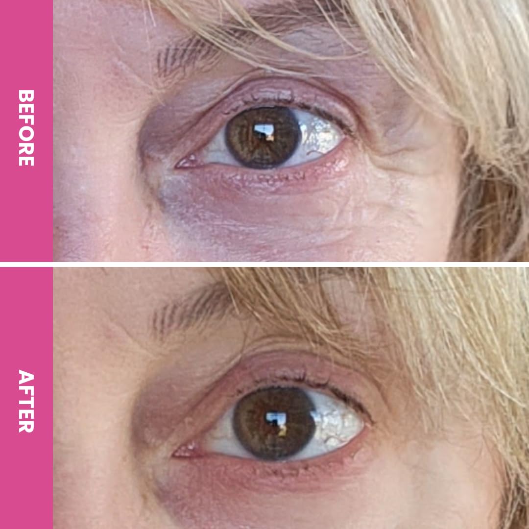 PRIME PROMETICS PrimeEyes Hydrate Under Eye Cream for Mature Women – Hydrating Eye Cream for Dark Circles and Wrinkle Repair – Soft, Glowing & Healthy Under Eyes