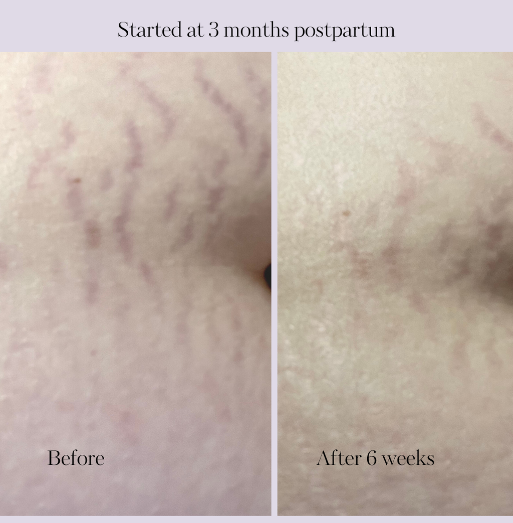 Revitalize Postpartum Cream 4oz