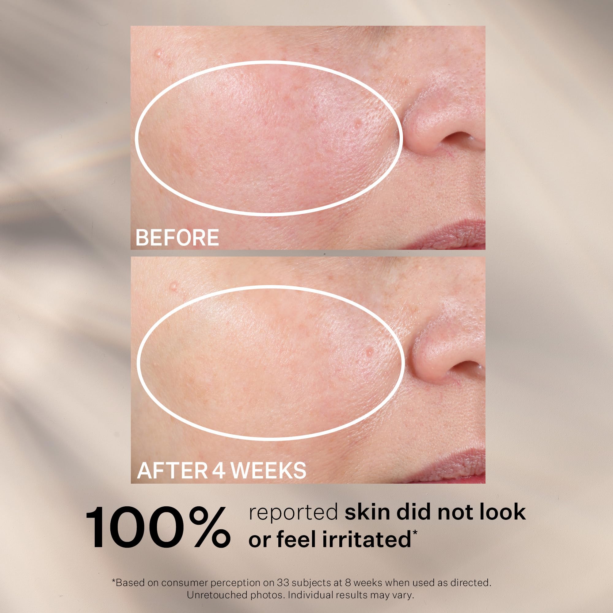 StriVectin Advanced Retinol Intensive Night Moisturizer, Targets Visible Signs of Aging for Healthier Skin, 1.7 Fl Oz