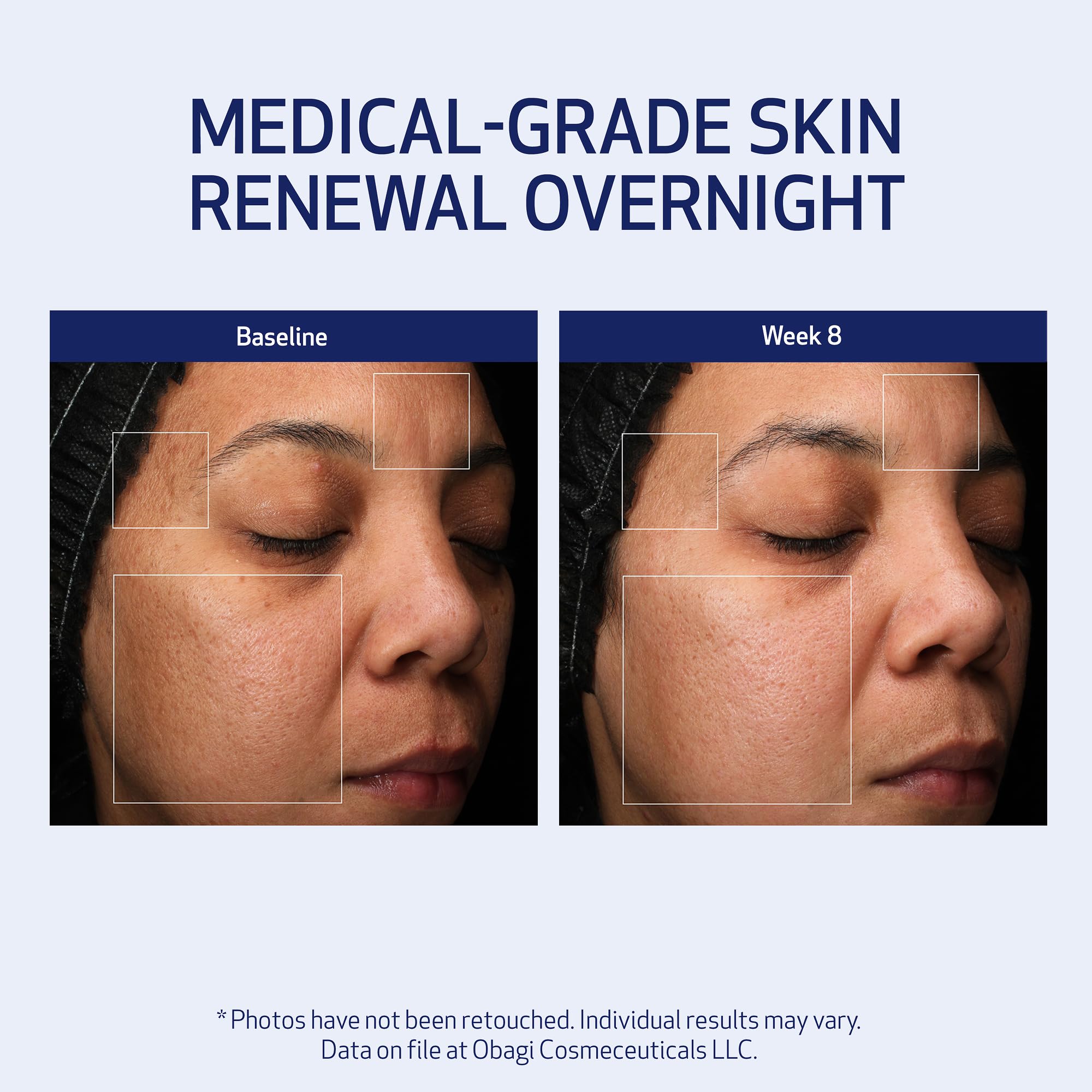 Obagi Medical Retinol + PHA Refining Night Cream - Clinically Proven, Dual-Action, Overnight Anti-Aging Face Cream for Smoother, Renewed Skin & a More Even-Looking Complexion - 1.7 Oz