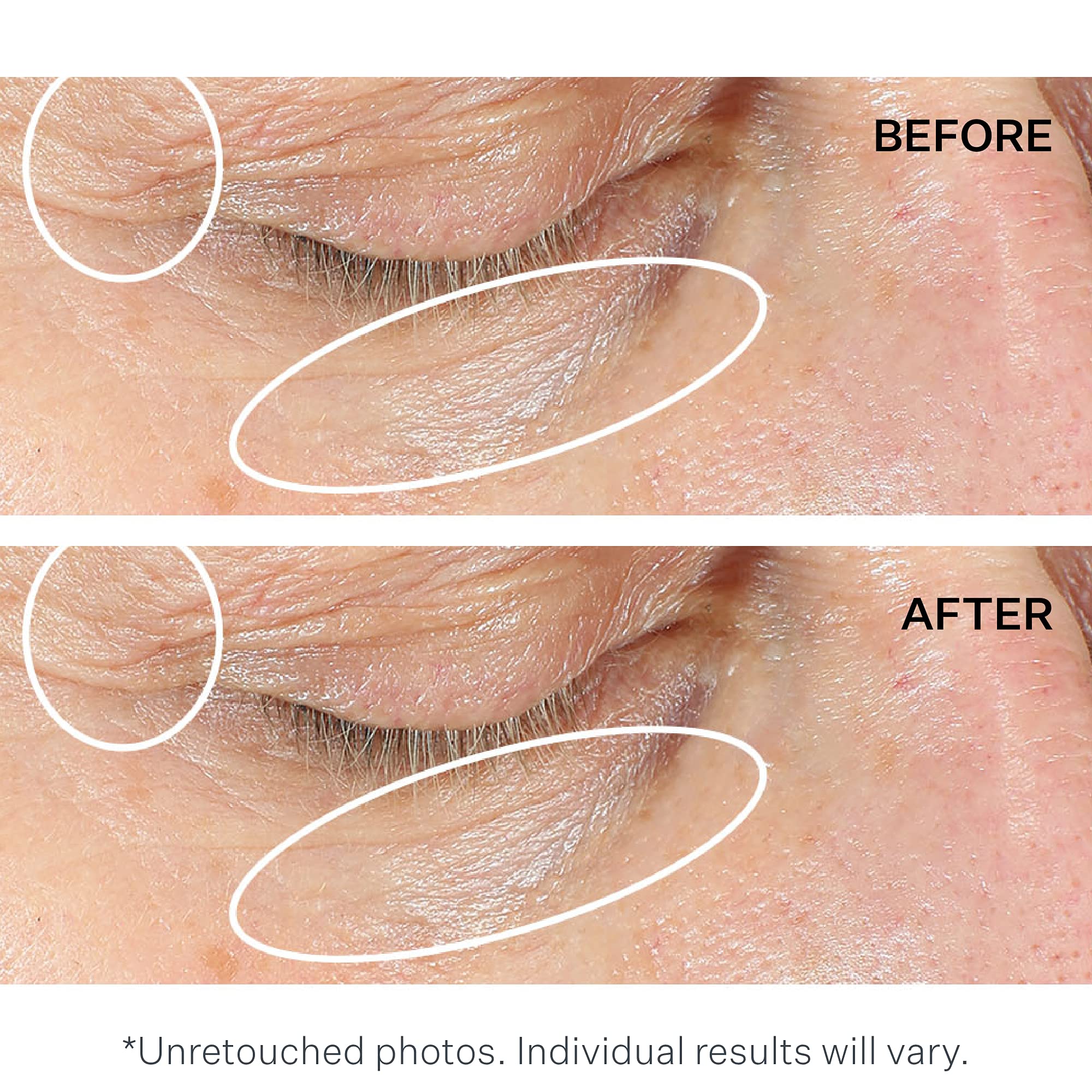 StriVectin Anti Wrinkle Trio Kit for Face and Eyes, 3 piece kit with SD Plus Moisturizer, Peptide Plump Line Face Serum, and Intensive Eye Concentrate Wrinkle Cream