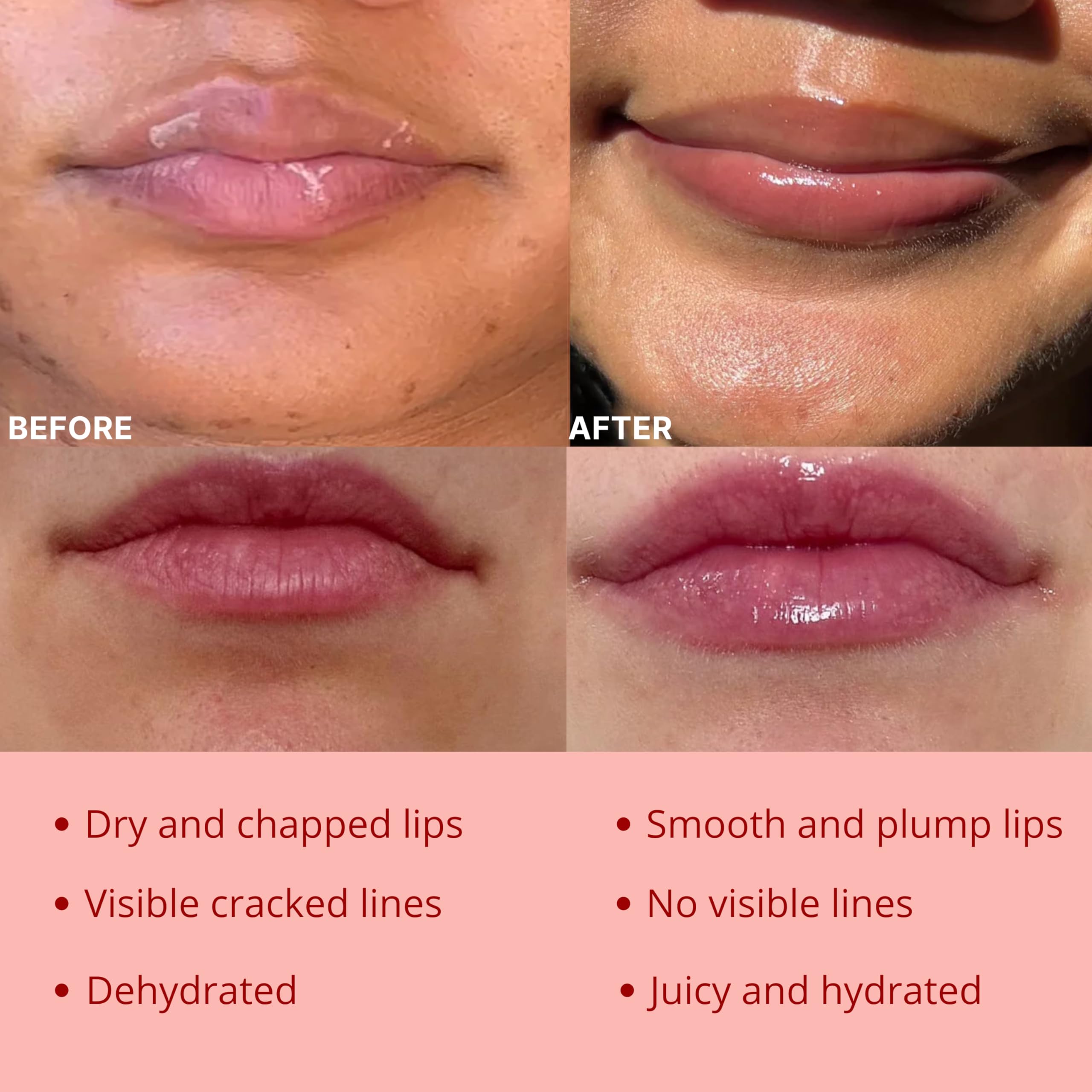 Original My Bee Balm Lip Balm - 2 pack Hydrating Balm Honey Pot for Dry, Chapped & Cracked Lips - Enriched with Propolis, Honey & Vitamin E - Soften, Smooth & Reduce Lip Lines