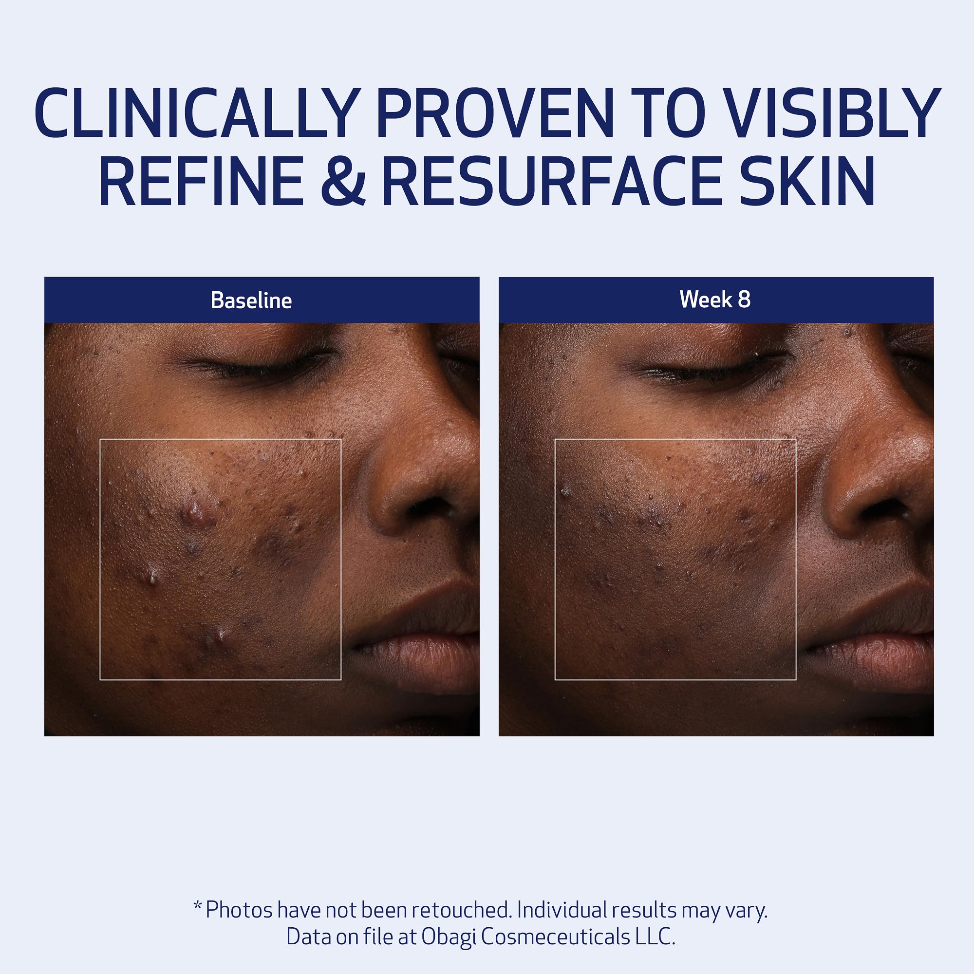 Obagi Medical Retinol + PHA Refining Night Cream - Clinically Proven, Dual-Action, Overnight Anti-Aging Face Cream for Smoother, Renewed Skin & a More Even-Looking Complexion - 1.7 Oz