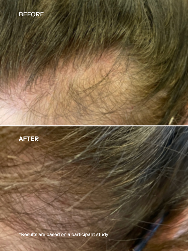 EXO ACTIVATE™ Follicle Enrichment Serum