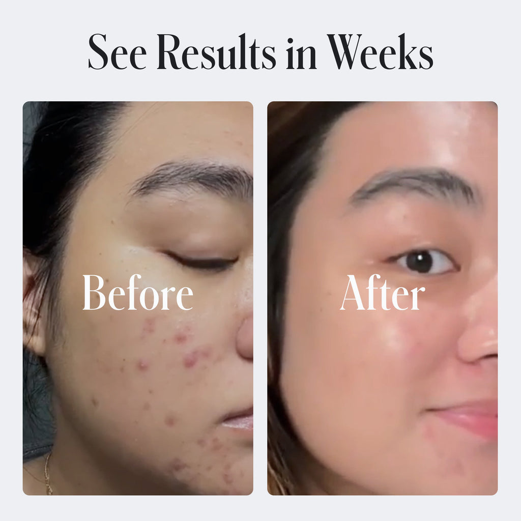 Clear Skin Face Cream