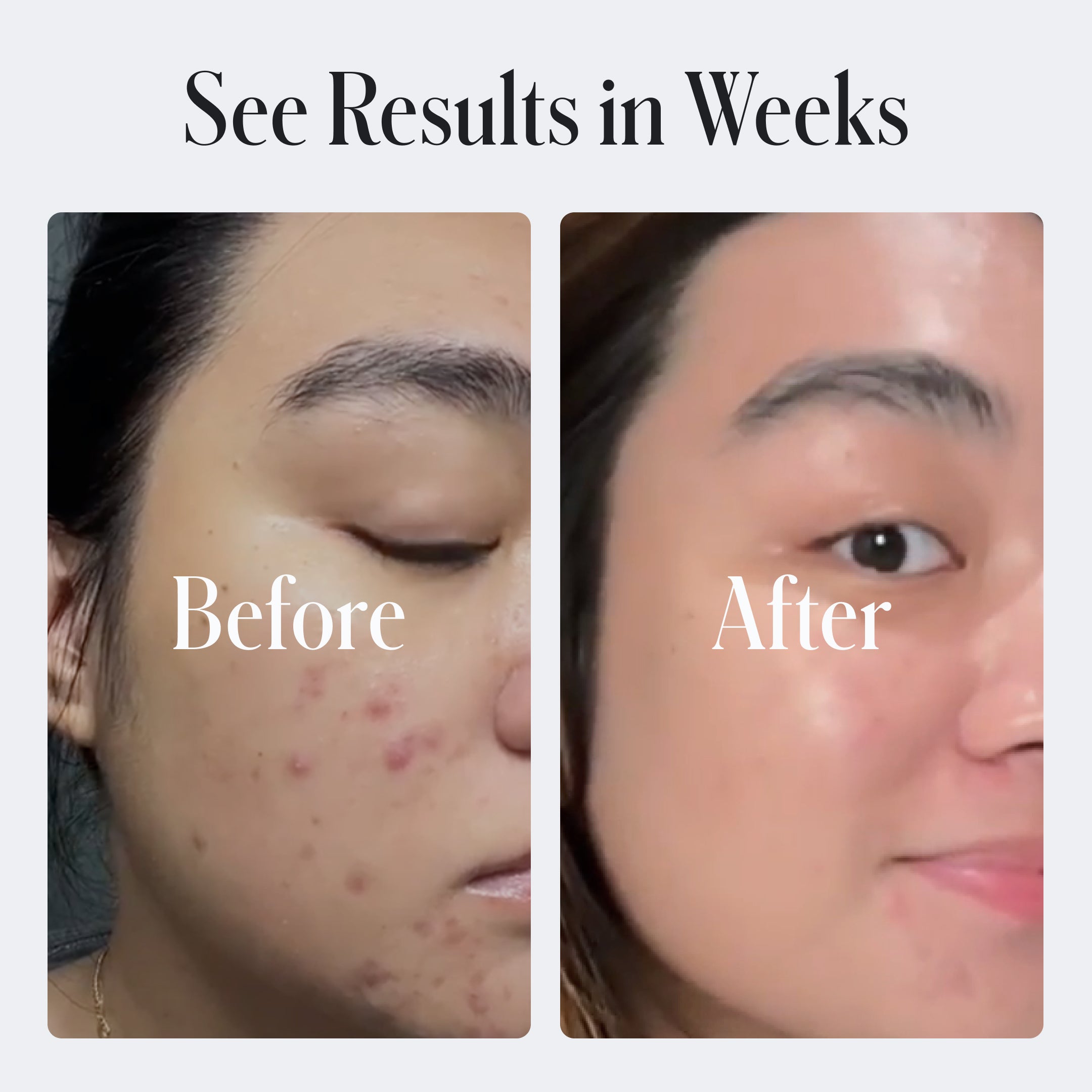 Clear Skin Face Cream