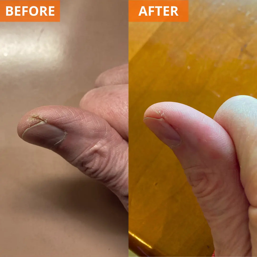 Moisturizing Skin Cream