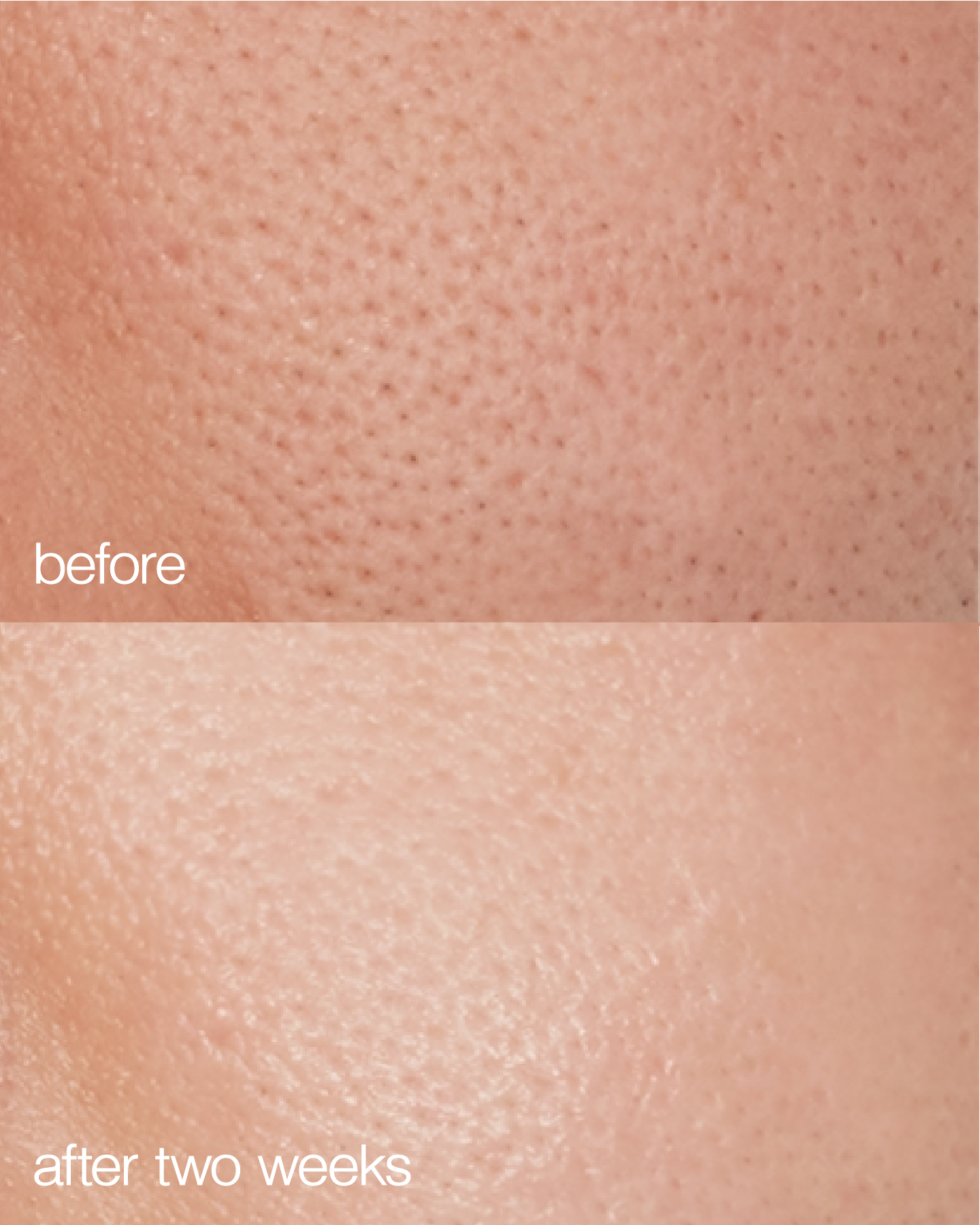 Biome Boost Cream Daily Moisturizer