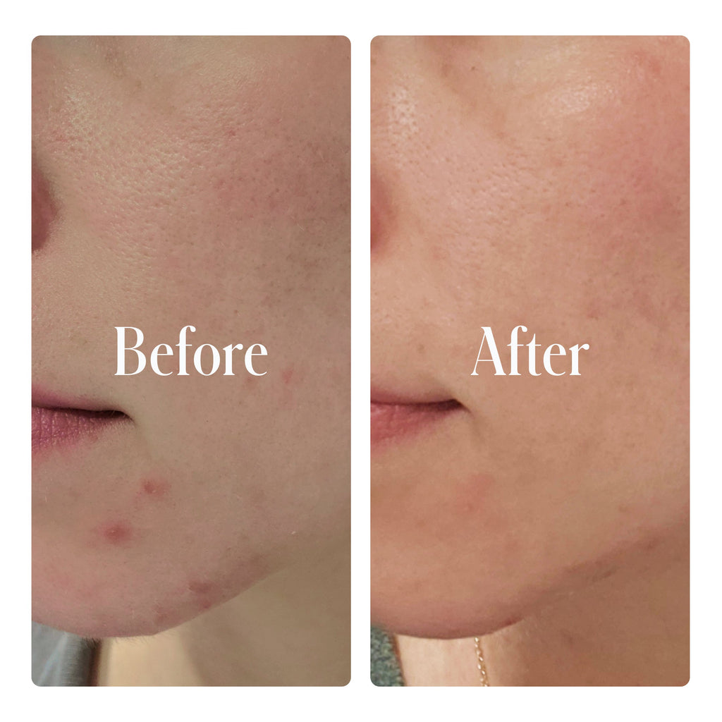 Clear System Full Routine