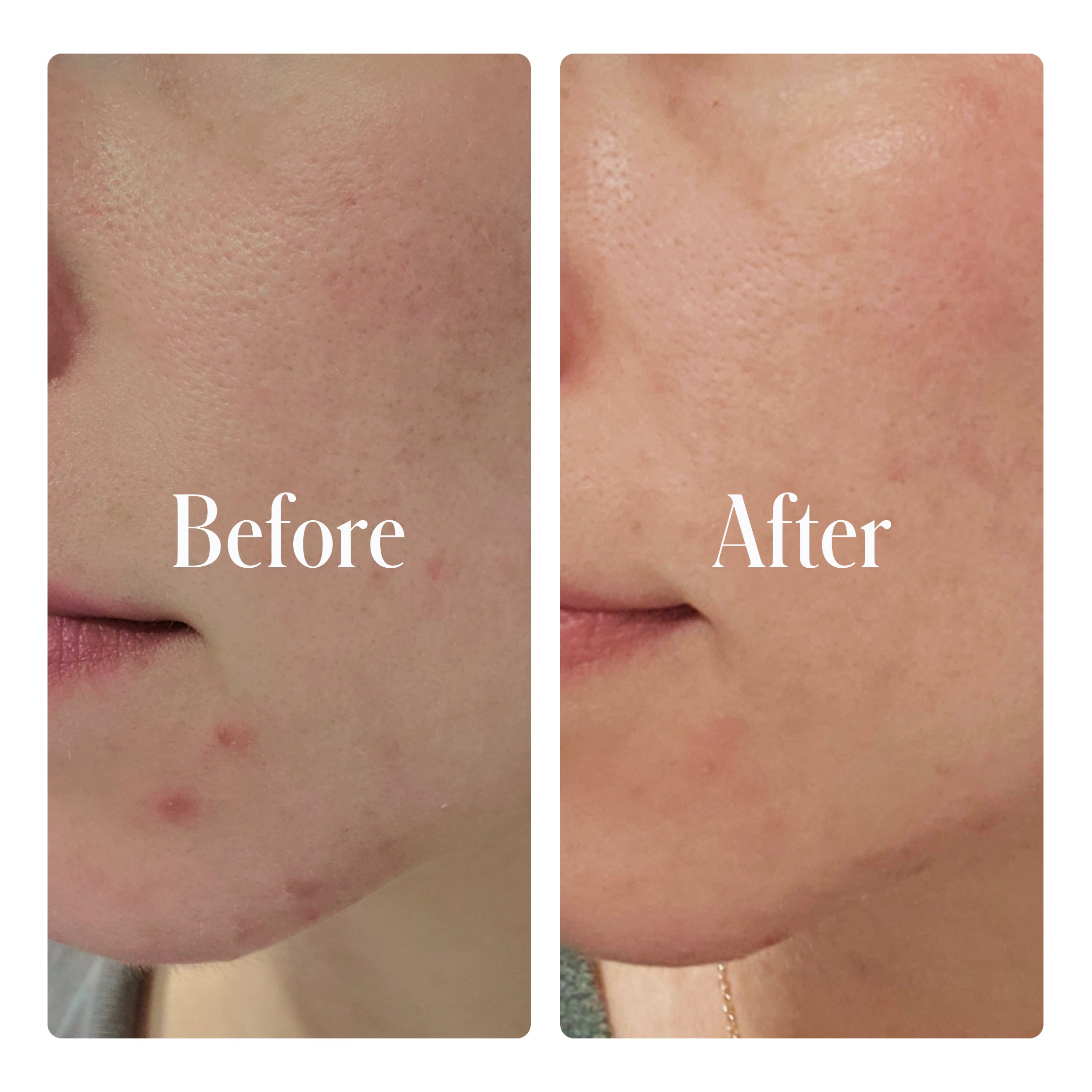 Clear System Face Routine